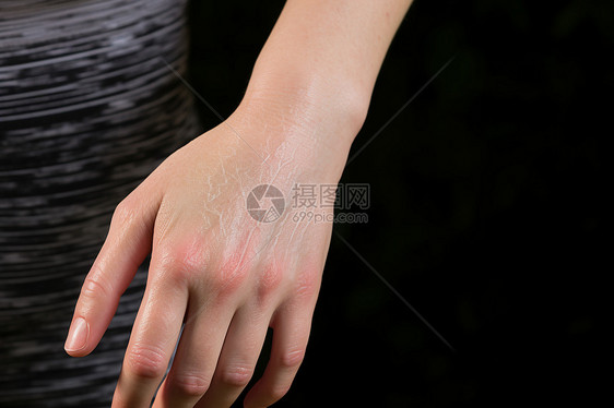 女人疼痛的手图片