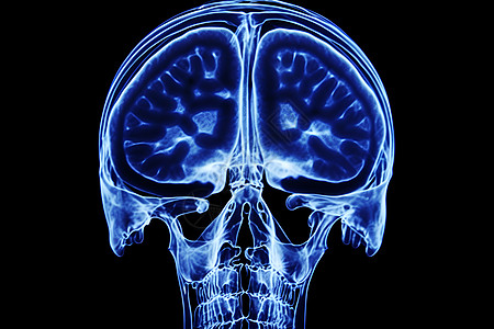 蓝色头部医学影像图片