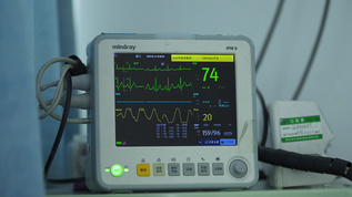 4k实拍医院重症监护心率检测仪视频素材