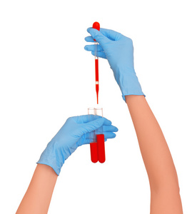 验血 血液试验图片