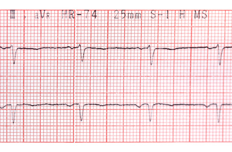 心电图机纸