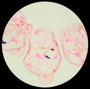显微切片显微镜下切片蕨叶(蕨叶sec)照片