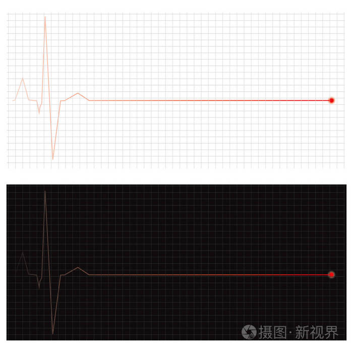 心脏停跳心电图图片图片