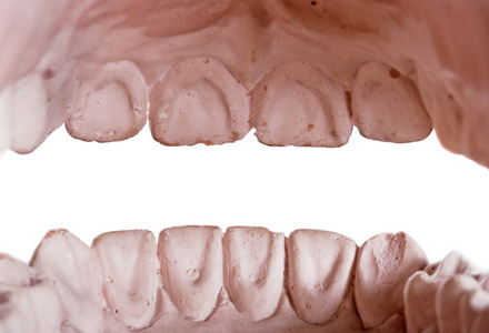 人体牙齿模型
