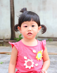 亚洲宝贝女孩眼睛肿起来，蚊子咬在眼后过敏
