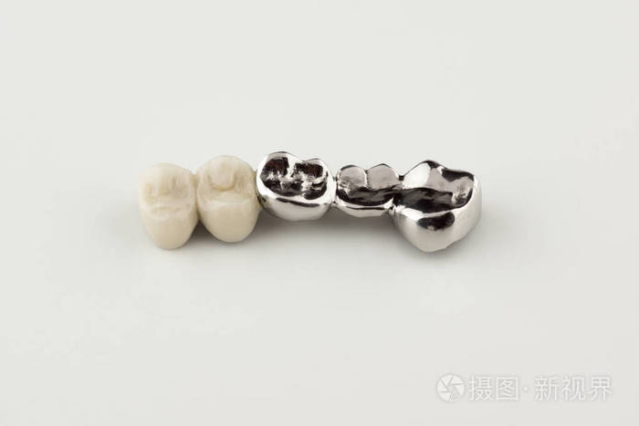 5000*3333px无水印下载免费10次/天下载小样发票合同问题/举报烤瓷冠