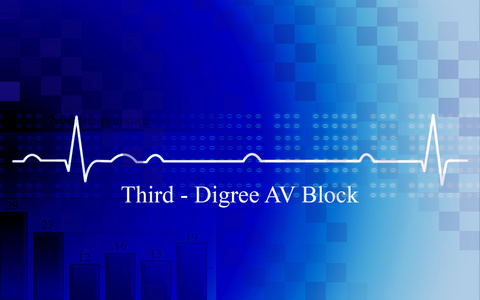 冠状动脉疾病三级av阻滞