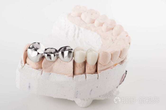 *3333px无水印下载免费10次/天下载小样发票合同问题/举报烤瓷冠修