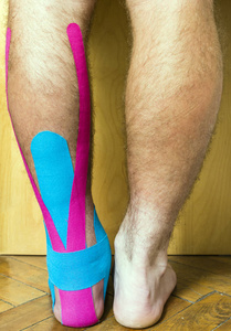 脚部有一个伤口，用胶带覆盖，用于弹性治疗