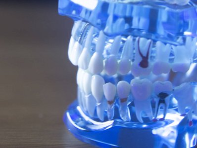 牙科牙齿根模型图片