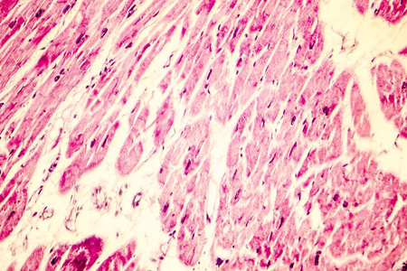 心肌细胞心脏肥大显微照片