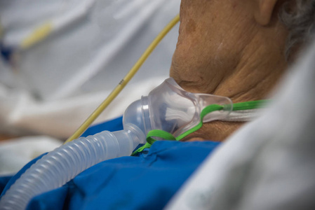 病人做气管切开 呼吸机在医院