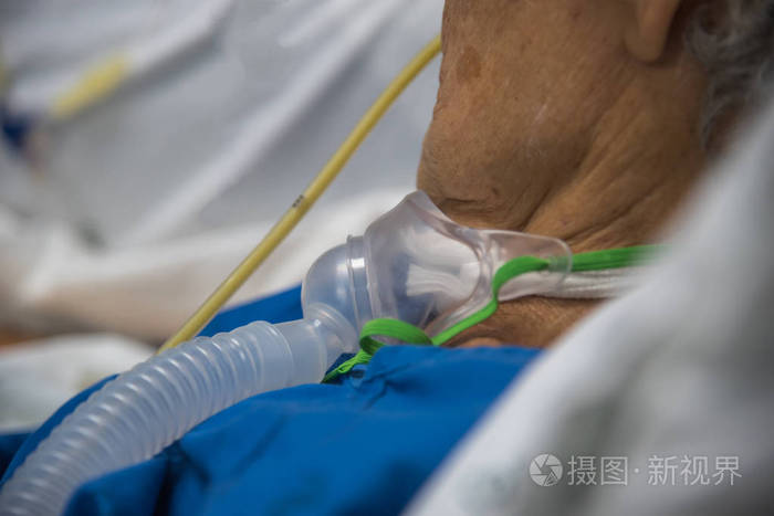 病人做气管切开, 呼吸机在医院