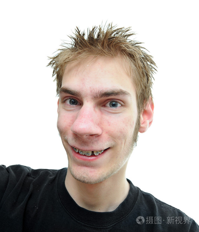 带着牙套的青少年微笑