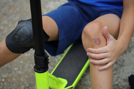 擦伤的膝盖的孩子。男孩腿受伤期间骑滑板车。孩子们的安全，使用保护膝盖垫概念