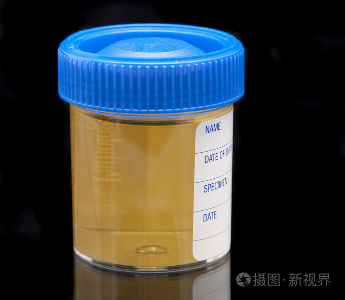 尿检试验