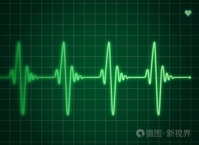 绿色心电图