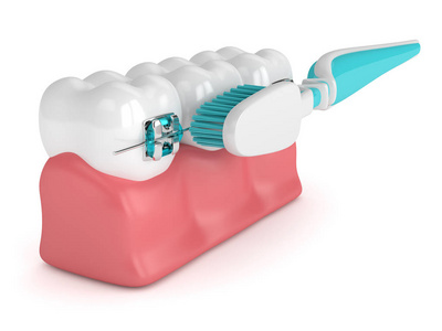 3d 用牙套和牙刷渲染牙齿