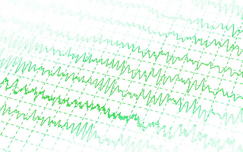 绿图脑波脑电图分离白色背景