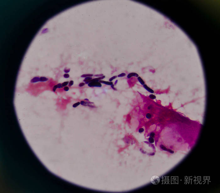 初露头角的酵母细胞中革兰染色方法照片 正版商用图片02kpo7 摄图新视界