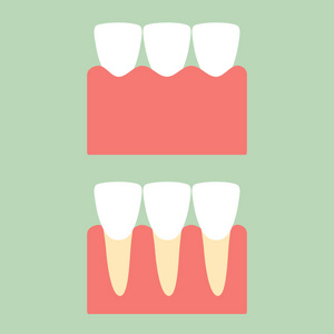 牙齿保健用牙龈上的健康门牙牙图片