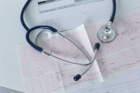 医生工作场所用听诊器心电图图与医疗表特写, 为心脏记录