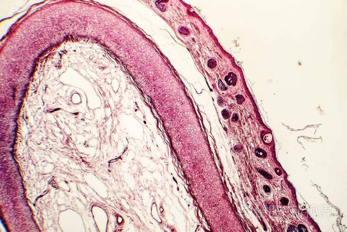 人外耳的弹性软骨
