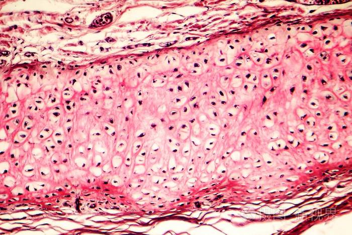 人外耳的弹性软骨
