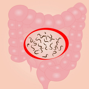小肠蠕虫3d 寄生蛔虫孤立黑色背景的图解微生物圆插图.
