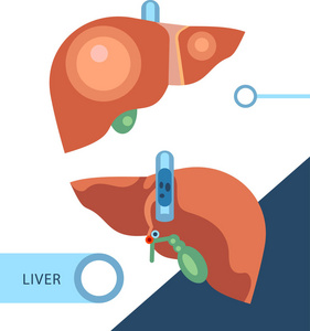 肝脏的图形化显示