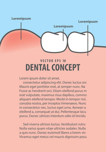 布局肿胀牙龈与牙齿框架卡通风格的信息或 b