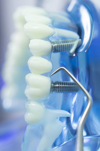 牙科牙齿牙医模型