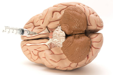 白色背景下的针注射器和人脑模型
