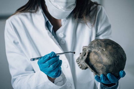 实验室法医科学法医检查颅骨的证据