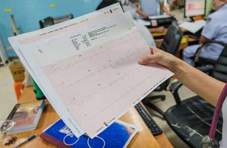 心脏分析, 心电图图 心电图 在手医生在医院