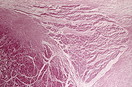 房室结房室结的高倍镜观察照片