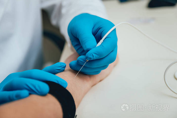 使用肌电图进行患者神经检测体检emg