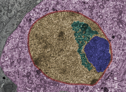 精母细胞性泡假彩色透射电镜照片