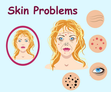 女性面部皮肤问题。化妆品的矢量插图