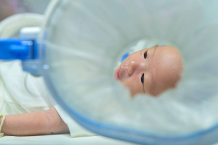新生女婴在医院的孵化器内得到光疗