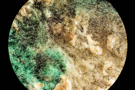 绿色霉菌在变质食品上的传播, 通过显微镜观察