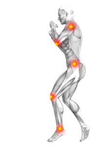 概念性人体肌肉解剖与红黄热斑炎症骨质疏松运动概念