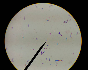 显微镜细菌图片