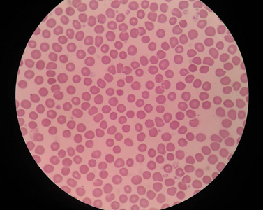 血红细胞医学背景
