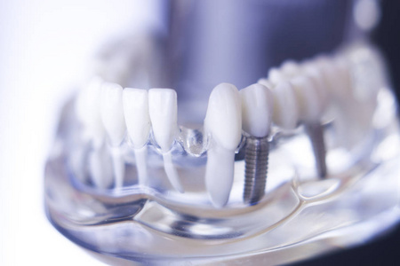 Dentsts 牙科牙齿模型