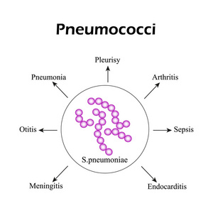 球菌。球菌疾病。信息图表。矢量图
