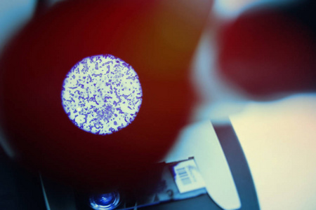 显微镜下分子显微镜下的淋病分子照片