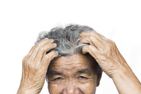 老妇人感到了很多焦虑的脱发问题的白色背景, 头皮问题的概念