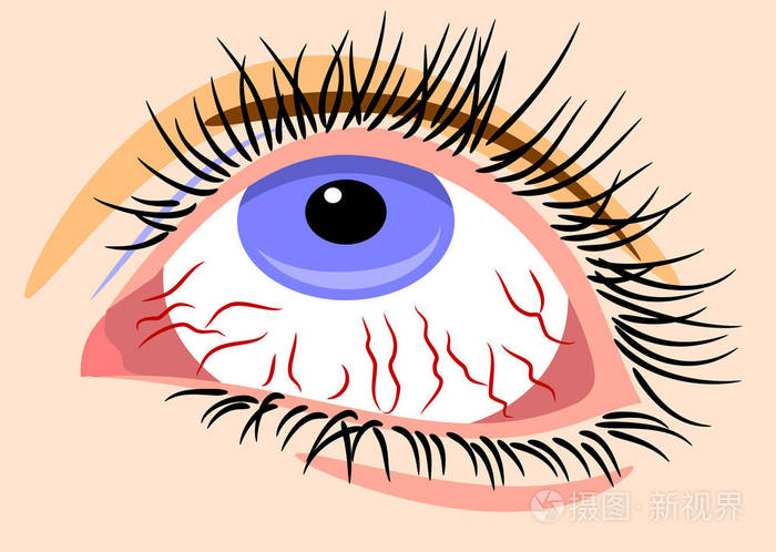 生病, 脸红, 水汪汪的眼睛