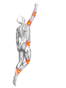 概念性人体肌肉解剖与红黄热斑炎症骨质疏松运动概念